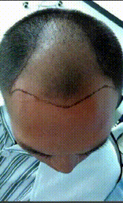 发际线分享社区