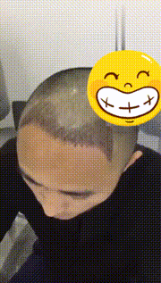 发际线分享社区