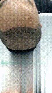 发际线分享社区