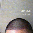 發(fā)際線用戶圖片