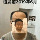 發(fā)際線用戶圖片