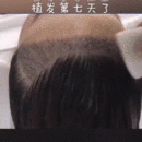 發(fā)際線用戶圖片