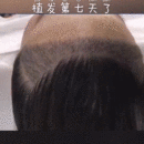 發(fā)際線用戶圖片
