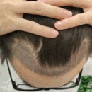 發(fā)際線用戶圖片