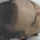 發(fā)際線用戶圖片