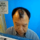 發(fā)際線用戶圖片
