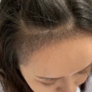 發(fā)際線用戶圖片