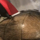 發(fā)際線用戶圖片
