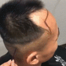發(fā)際線用戶圖片