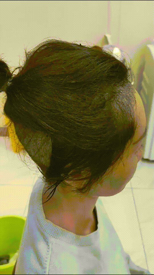 发际线分享社区