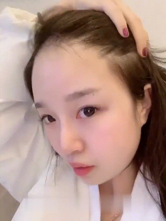 发际线分享社区