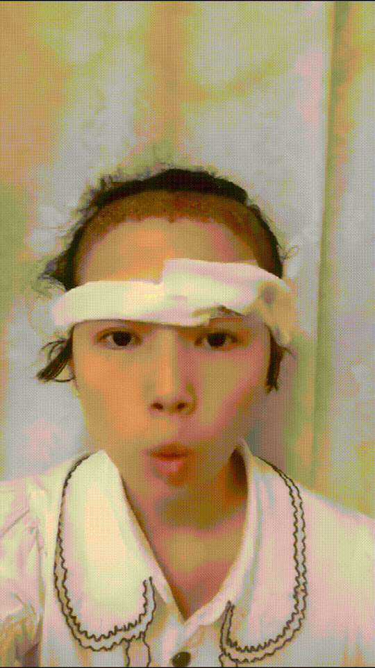 发际线分享社区