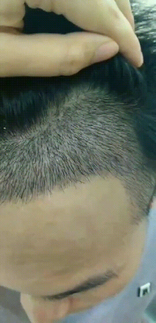 发际线分享社区