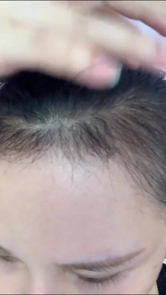 发际线分享社区