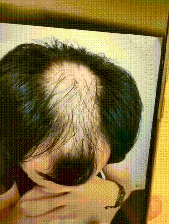 发际线分享社区