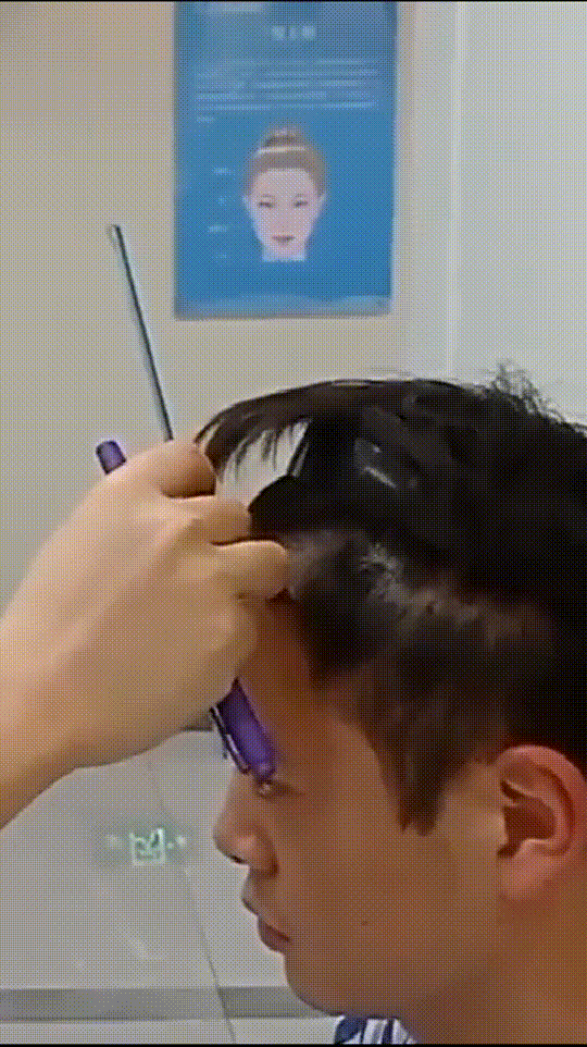 发际线分享社区