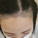 發(fā)際線用戶圖片