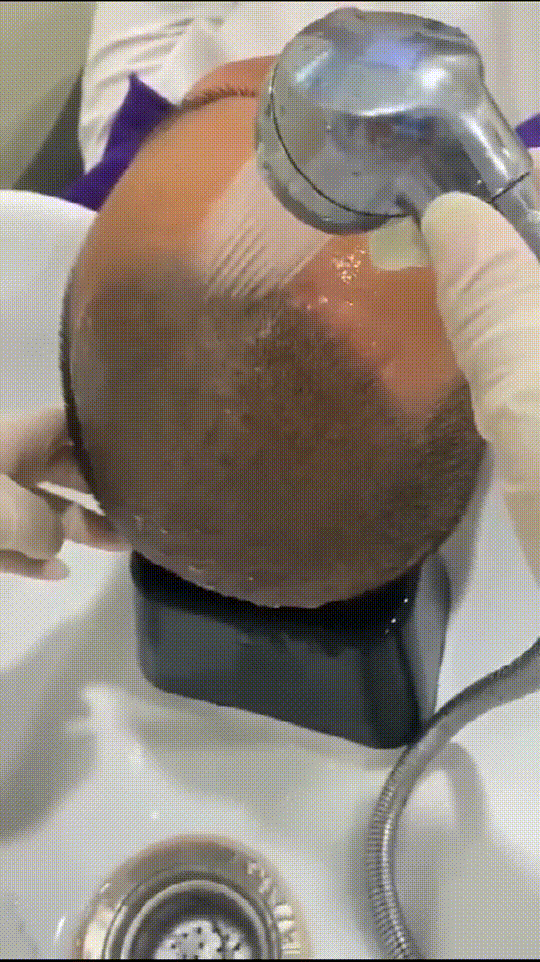 发际线分享社区