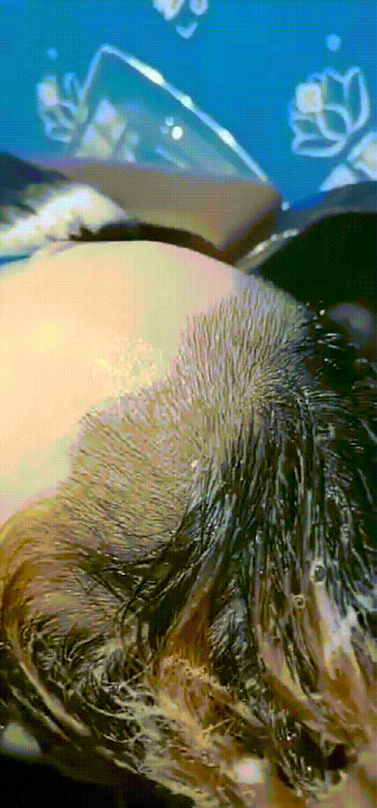 发际线分享社区