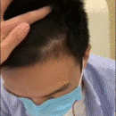 發(fā)際線用戶圖片
