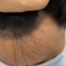 發(fā)際線用戶圖片