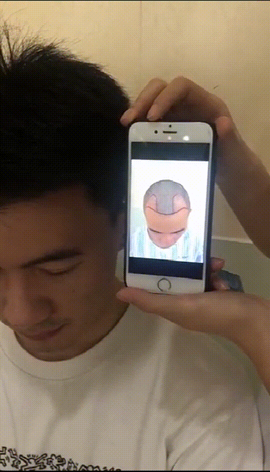 发际线分享社区