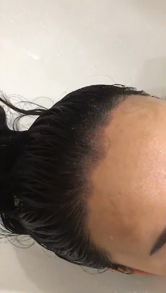发际线分享社区
