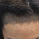 發(fā)際線用戶圖片
