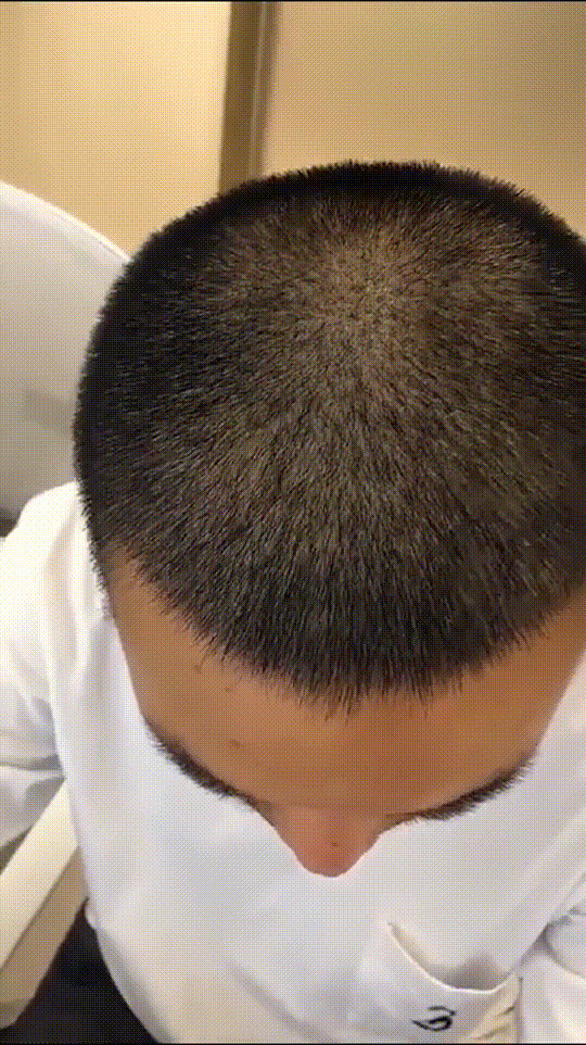 发际线分享社区