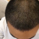 發(fā)際線用戶圖片