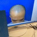 發(fā)際線用戶圖片