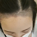 發(fā)際線用戶圖片