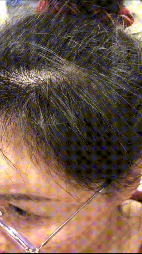 发际线分享社区