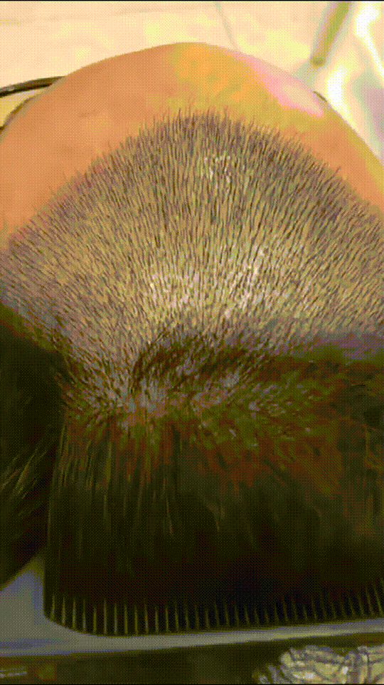 发际线分享社区