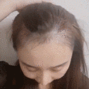 發(fā)際線用戶圖片