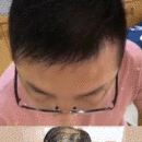 發(fā)際線用戶圖片