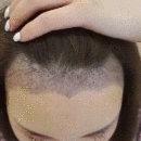 發(fā)際線用戶圖片