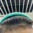 發(fā)際線用戶圖片