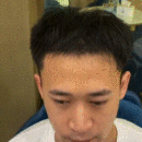 發(fā)際線用戶圖片