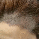 <font color="red">美人尖</font>用戶圖片