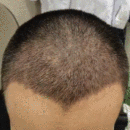 發(fā)際線用戶圖片