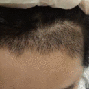發(fā)際線用戶圖片