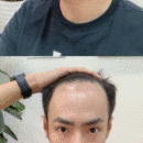 發(fā)際線用戶圖片