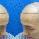 發(fā)際線用戶圖片