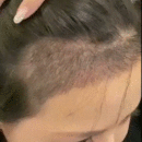 發(fā)際線用戶圖片